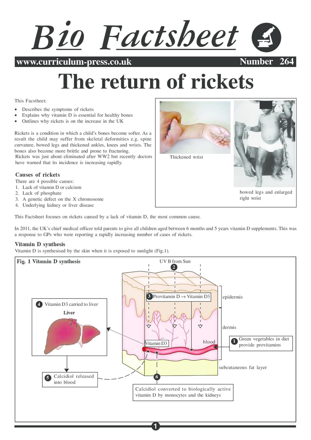 The Return of Rickets - Curriculum Press