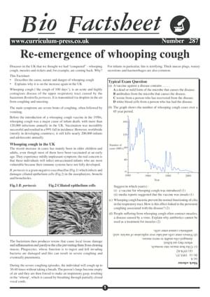 287 Whooping Cough