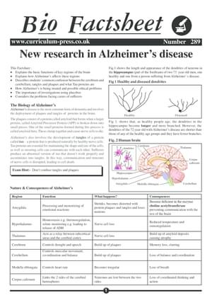 289 Alzheimers Disease