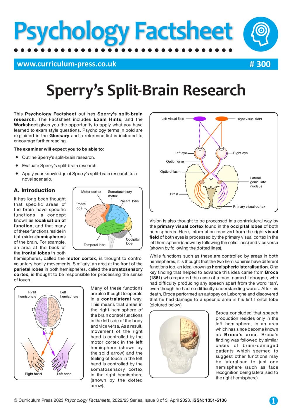 research paper on split brain